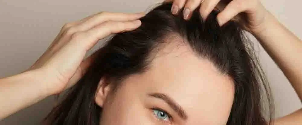 meilleure poudre densifiante cheveux fibre capillaire anti calvitie